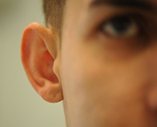 Otoplasty / Protruding Ears