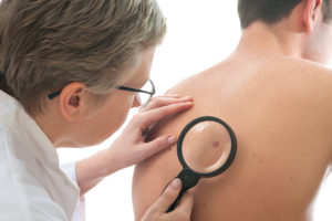 Skin Cancer Surgery Nashua, NH 