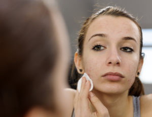 Skin Care Tips For Your Pre-teens and Teens